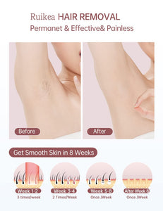 Ipl Laser Hair Removal Handset